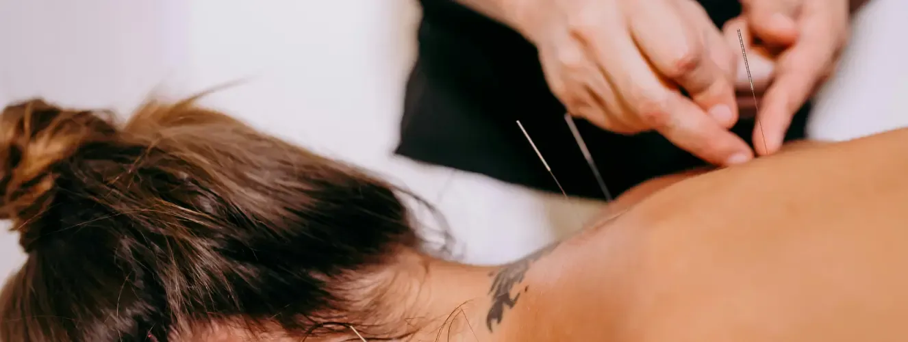 Dry Needling